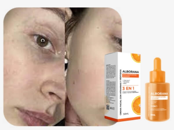 What Is Alborana and What Does It Serve For