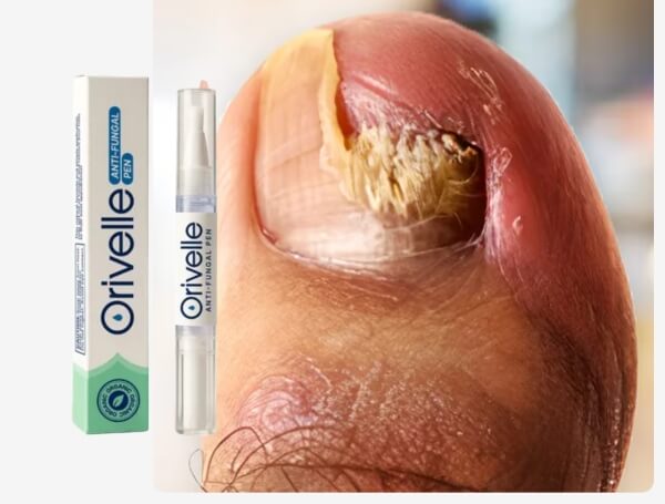 Orivelle pen Reviews Norway Germany France - Opinions, price, effects