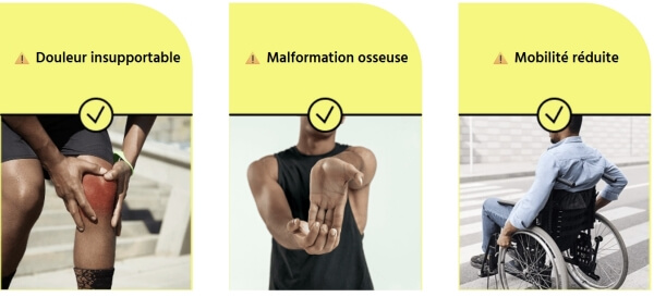 How to Use Tromagel – Instructions How to Use Tromagel – Instructions