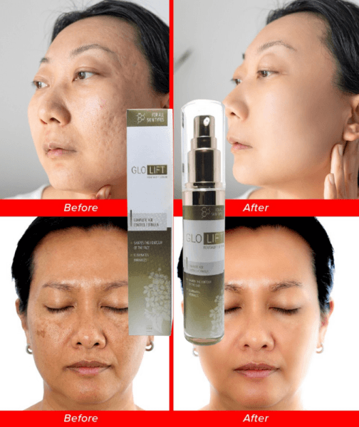 GloLift Price in Indonesia – Where Is It Sold